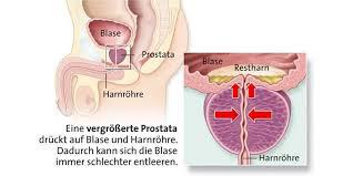 prostata drückt)